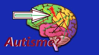 AutismeHoe werkt het brein [upl. by Felske]