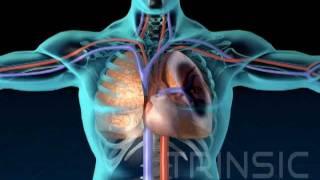 Pulmonary Embolism Medical Animation [upl. by Eilyak]