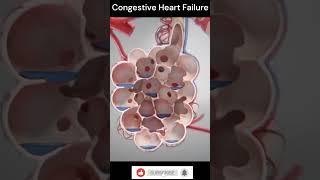 Congestive Heart Failure Explain 3DAnimation shorts [upl. by Turnbull]