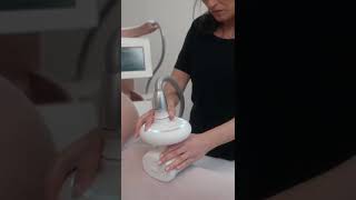 Elimina celulitis con LPG endermologie Corporal México  Sakura Spa [upl. by Yemar825]