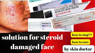 cure for fairness cream and steroid damaged face how to stop skinshineskinlite betnovate creams [upl. by Scurlock807]