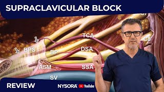 Supraclavicular Block WHY HOW WHERE AND WHAT’S NEW [upl. by Alemac455]