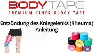 Kinesiology Tape Anleitung Entzündung des Kniegelenks Rheuma [upl. by Nichols616]