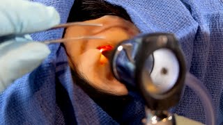 ASMR Removing a Foreign Object from Your Ear  Doctor amp Patient POV  Hearing Test [upl. by Dnumde451]