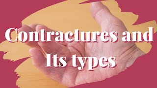 Contractures and types of contractures Therapeutics [upl. by Negem142]