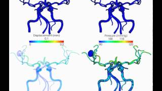 Simulation of blood flow in cerebral arteries [upl. by Anthe382]