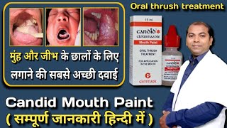 Candid mouth paint uses and side effects [upl. by Buehrer609]