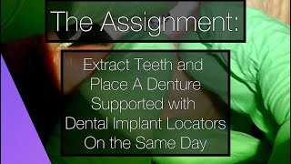 Selective Extractions and Implant Placement for Locator Attachments [upl. by Akemed]