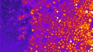 Calcium imaging in keratinocytes with Fluo4AM dye [upl. by Loftis]