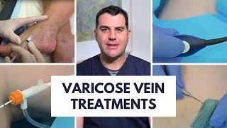 Varicose Vein Treatment Options  Dr Peter Paraskevas from Vein Health Medical Clinic [upl. by Bevvy]