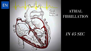 Atrial Fibrillation AFib Animation and ECG Shorts [upl. by Derk484]