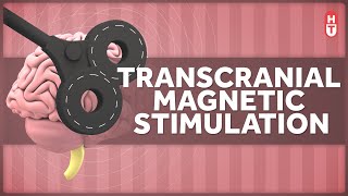 Transcranial Magnetic Stimulation How Does that Work [upl. by Dovev]