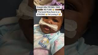 GERMIA amp GERMERE 🥹🥰 feedingtube bigfamily explorepage [upl. by Tomchay]