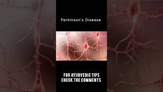 Parkinsons Disease Is Curable shorts ayurveda [upl. by Ardnuat]