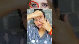 ♨️🤯 7days yoga for reduce dark circle eyewrinkleseyebags wrinkles free eyes try it 📛🤯shorts [upl. by Donnenfeld970]