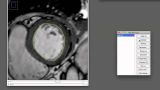 ImageJ Contour Drawing Procedure [upl. by Acire41]