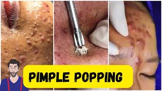 Pimple compilation 😧 satisfying pimple popping pimple pimplepopping [upl. by Bluh61]