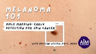 How to Use Mole Mapping to Detect Skin Cancer [upl. by Yorled]