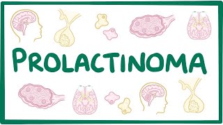 Prolactinoma  causes symptoms diagnosis treatment pathology [upl. by Weir840]