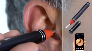 Nettoyeur doreille connecté avec caméra Full HD Newgen Medicals OTOSCOPE PEARLTVFR [upl. by Erised]