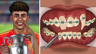 ASMR Help Lamine Yamal brace his ugly teeth  Dental care [upl. by Lankton]