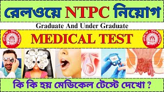 Railway NTPC Medical Test 2024  RRB NTPC Recruitment 2024  Railway Jobs 2024  rrbntpc job [upl. by Naud]