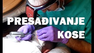 TRANSPLANTACIJA KOSE  Vlog 063 [upl. by Ohcirej386]