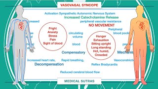 What is syncope and how to manage it [upl. by Seiuqram]