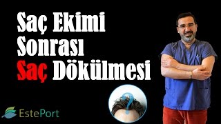 Saç Ekimi Sonrası Saç Dökülmesi [upl. by Dowd156]