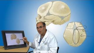 Craniosynostosis and its treatment  Boston Children’s Hospital [upl. by Nayra]