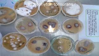 Dermatofitosis  Trichophyton spp  Cultivo  Pura Ciencia [upl. by Woodall]