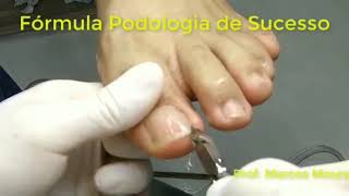 Curso de Podologia online [upl. by Faubert891]