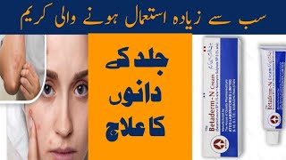 Betaderm N Cream uses in Urdu  Acne Cream Review [upl. by Ahtrim]