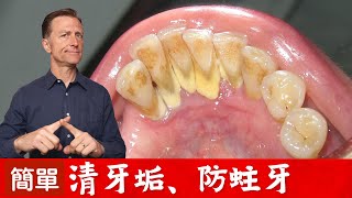 牙齒3天然自助清牙垢！怎樣預防蛀牙？柏格醫生 Dr Berg [upl. by Assylem51]