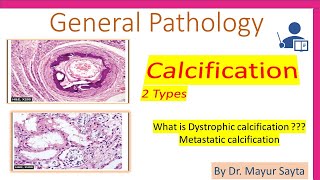 Pathological Calcification [upl. by Maryly]