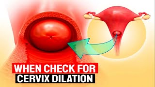 How to Check Cervical Dilation During Pregnancy  Causes amp Complications Explained [upl. by Ozzy415]