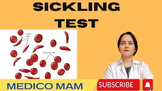 SICKLING TESTSICKLIE CELL ANEMIAExplained in Hindi 👍👍 [upl. by Battat392]