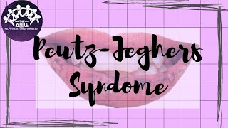 Quick Discussion Series  PeutzJeghers Syndrome [upl. by Theis316]