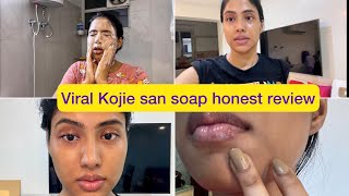 Skin lightening soap  Kojie san soap most honest review Yashi Tank [upl. by Alcus]