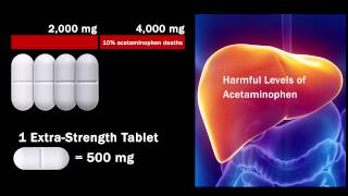 Is Tylenol Dangerous [upl. by Rheingold]