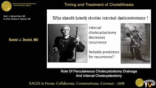 Percutaneous cholecystostomy amp interval cholecystectomy [upl. by Enicar]