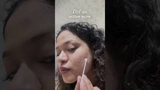 Overnight Acne Spot Corrector  How to Use [upl. by Aicnorev]