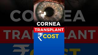 Cornea Transplant Cost [upl. by Esiole730]