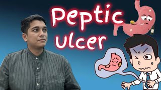 Get rid of PEPTIC ULCERS pepticulcer gastriculcer ulcertreatment homoeopathy [upl. by Aseneg756]