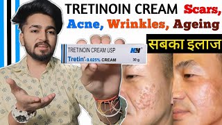 Tretinoin Cream Complete Information  Tretinoin Cream Benifits and Side Effects  Tretin Cream [upl. by Ennayelhsa]