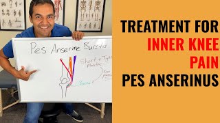 How To Cure Inner Knee Pain Caused By Pes Anserine Bursitis Easy Self Treatment That Works [upl. by Hcib]