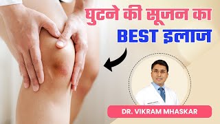 घुटने में सूजन क्या होता है घुटने की सूजन का Best इलाज  Best Doctors for Knee Effusion in Delhi [upl. by Erena]