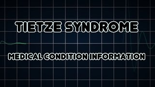 Tietze syndrome Medical Condition [upl. by Oigres]