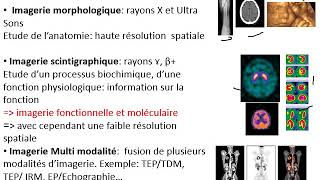 PRINCIPE DE L IMAGERIE EN MEDECINE NUCLEAIRE [upl. by Yur9]