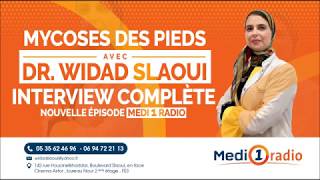 La mycose des pieds Dr Widad SLAOUI [upl. by Ylahtan]